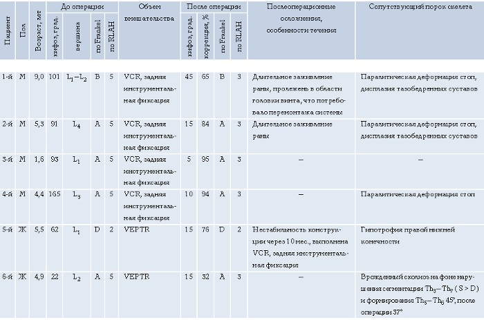 Хирургическое лечение кифоза